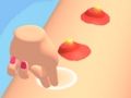 თამაში ჭკვიანური ჩახშობა pimples  ონლაინ
