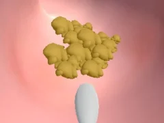 თამაში Earwax Clinic ონლაინ