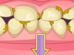 თამაში Bad Teeth Makeover ონლაინ