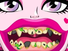 თამაში Draculaura Bad Teeth ონლაინ