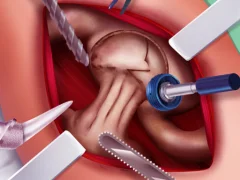 თამაში Princess Hips Surgery ონლაინ