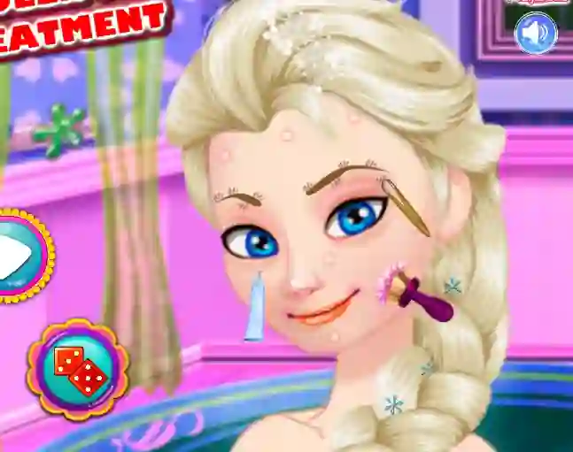 თამაში Ice Queen Acne Treatment ონლაინ