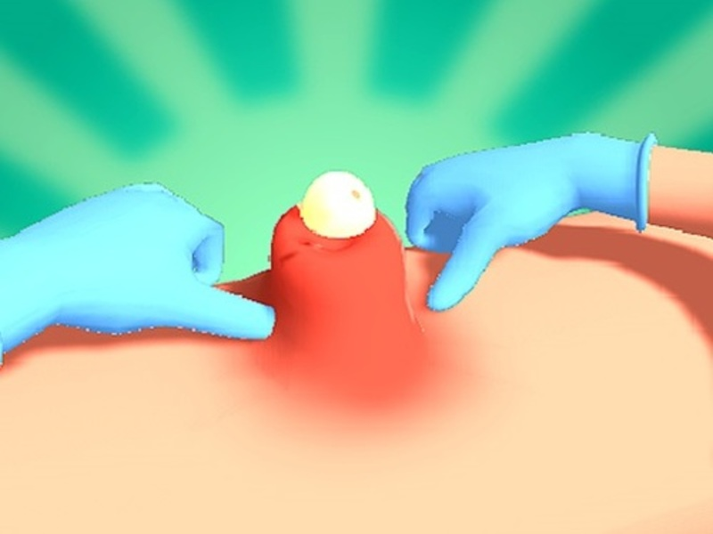 თამაში Pimple squeeze ონლაინ
